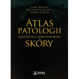 Atlas patologii złośliwych nowotworów skóry 