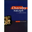 Choroby naczyñ Wybrane problemy