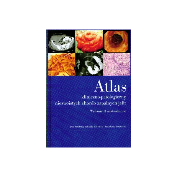 Atlas kliniczno-patologiczny nieswoistych chorób zapalnych jelit