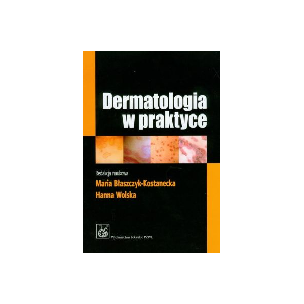 Dermatologia w praktyce