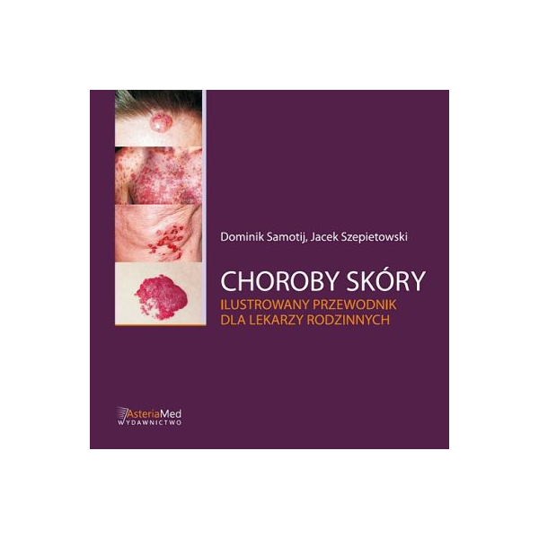 Choroby skóry
Ilustrowany przewodnik dla lekarzy rodzinnych