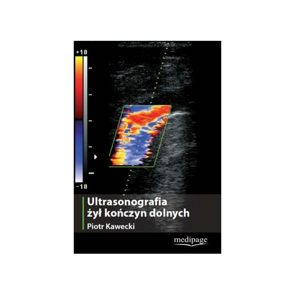 Ultrasonografia żył kończyn dolnych