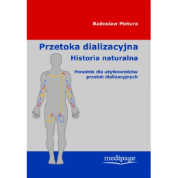 Przetoka dializacyjna Historia naturalna Poradnik dla użytkowników przetok dializacyjnych