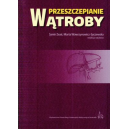 Przeszczepianie wątroby