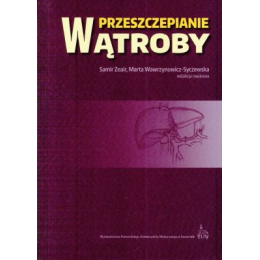 Przeszczepianie wątroby