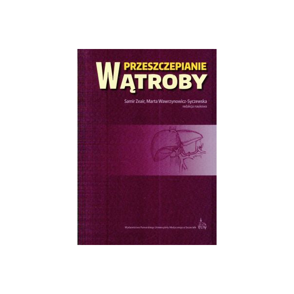 Przeszczepianie wątroby