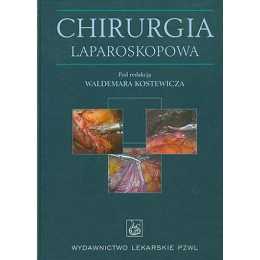 Chirurgia laparoskopowa