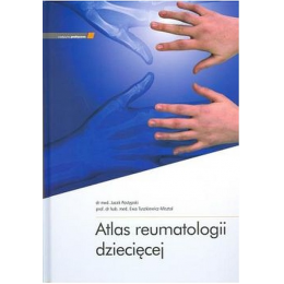 Atlas reumatologii dziecięcej