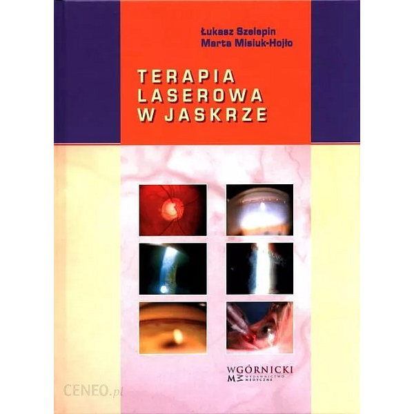 Terapia laserowa w jaskrze