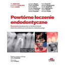 Powtórne leczenie endodontyczne