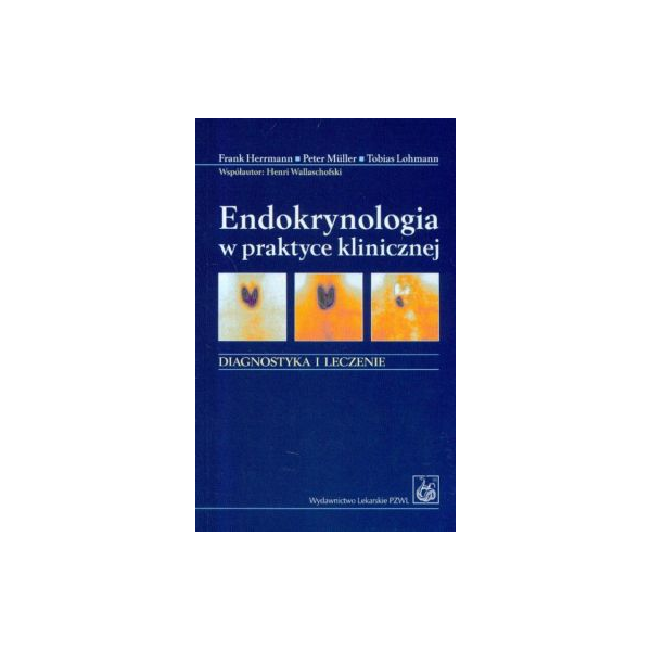 Endokrynologia W Praktyce Klinicznej Diagnostyka I Leczenie 0537