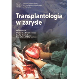 Transplantologia w zarysie
