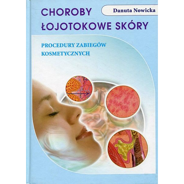 Choroby łojotokowe skóry Procedury zabiegów kosmetycznych