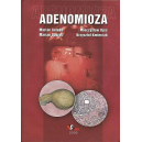 Adenomioza