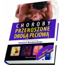 Choroby przenoszone drogą płciową z CD