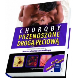 Choroby przenoszone drogą płciową z CD