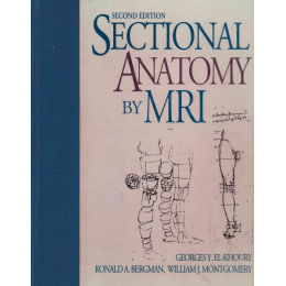 Sectional Anatomy by MRI