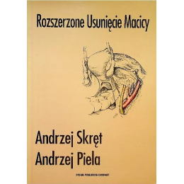 Rozszerzone usunięcie macicy