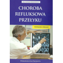 Choroba refluksowa przełyku Poradnik dla pacjenta