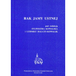 Rak jamy ustnej