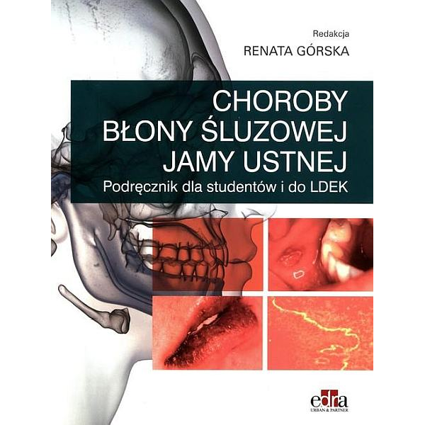 Choroby błony śluzowej jamy ustnej 