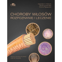 Choroby włosów. Rozpoznanie i leczenie 