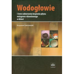 Wodogłowie i inne zaburzenia krążenia płynu mózgowo-rdzeniowego u dzieci i inne zaburzenia krążenia płynu mózgowo-rdzeni