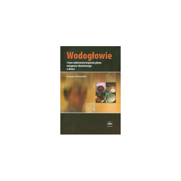 Wodogłowie i inne zaburzenia krążenia płynu mózgowo-rdzeniowego u dzieci i inne zaburzenia krążenia płynu mózgowo-rdzeni