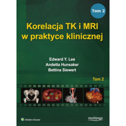 Korelacja TK i MRI w...