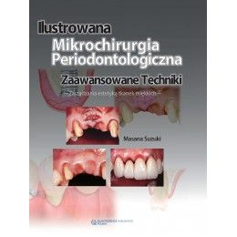 Ilustrowana mikrochirurgia periodontologiczna zaawansowane techniki-zarządzanie estetyką tkanek miękkich