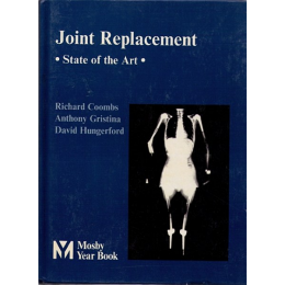 Joint Replacement State of the Art