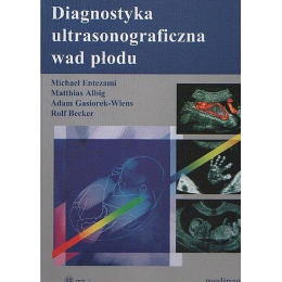 Diagnostyka ultrasonograficzna wad płodu