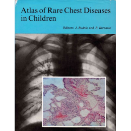 Atlas of Rare Chest...