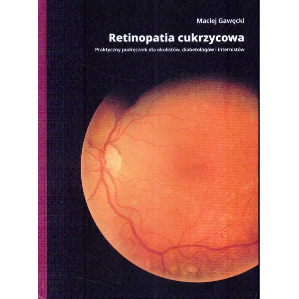 Retinopatia cukrzycowa Praktyczny podręcznik dla okulistów, Diabetologów i internistów