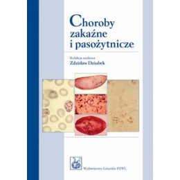 Choroby zakaźne i pasożytnicze