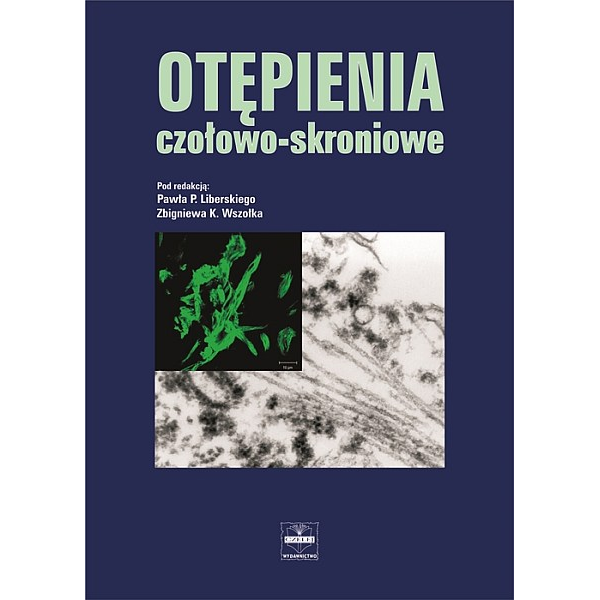 Otępienia czołowo-skroniowe