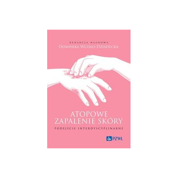 Atopowe zapalenie skóry podejście interdyscyplinarne